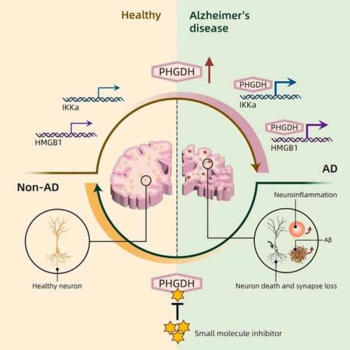 IA revela causa oculta do Alzheimer e aponta possível tratamento em forma de pílula